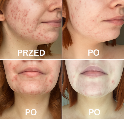 Lunérie™ Champagne Jedwabna Poszewka na Poduszkę